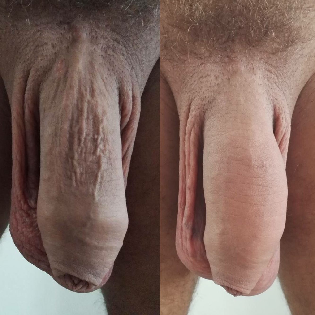 Lubrification du sexe anal